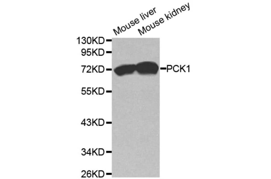 Western blot - PCK1 Antibody from Signalway Antibody (32565) - Antibodies.com
