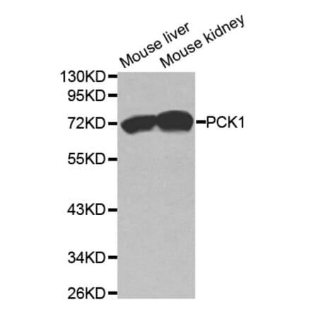 Western blot - PCK1 Antibody from Signalway Antibody (32565) - Antibodies.com