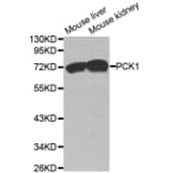 Western blot - PCK1 Antibody from Signalway Antibody (32565) - Antibodies.com