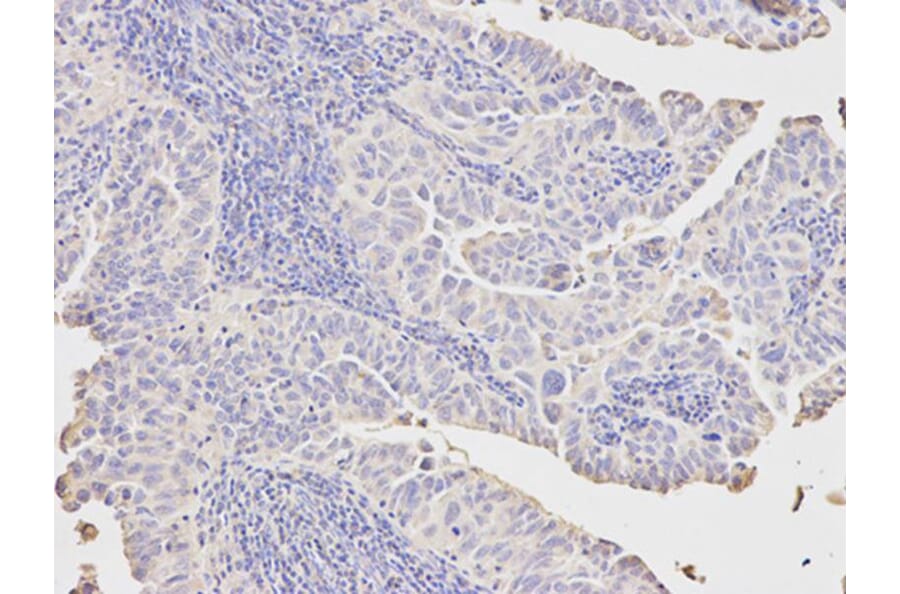Immunohistochemistry - PCK1 Antibody from Signalway Antibody (32565) - Antibodies.com