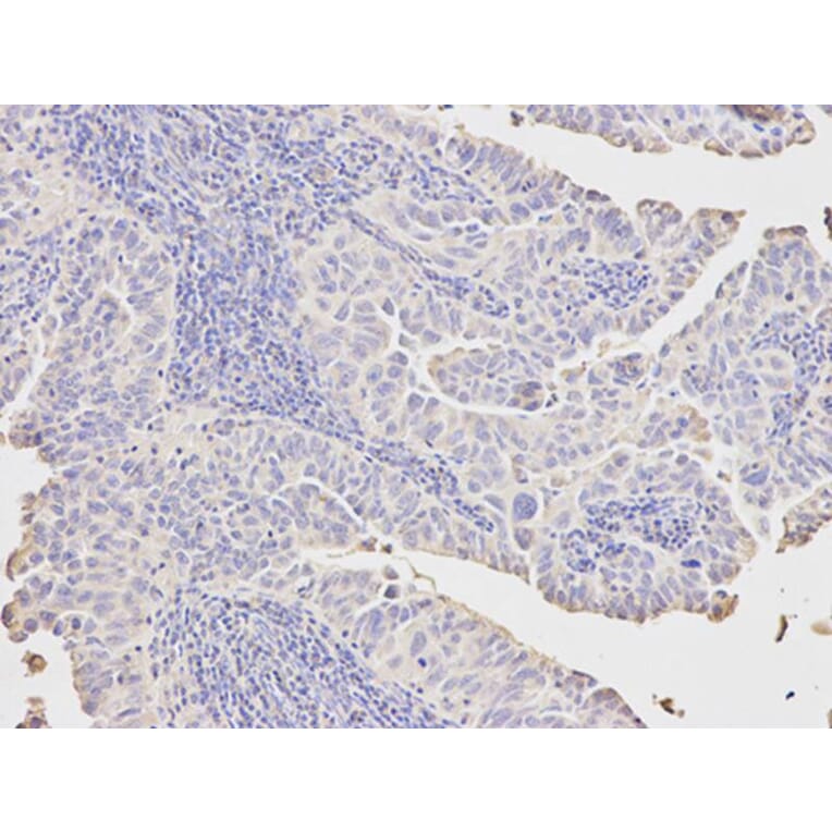 Immunohistochemistry - PCK1 Antibody from Signalway Antibody (32565) - Antibodies.com