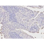 Immunohistochemistry - PCK1 Antibody from Signalway Antibody (32565) - Antibodies.com