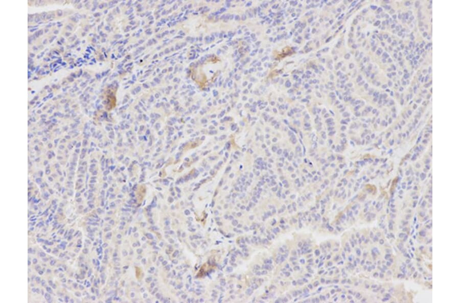 Immunohistochemistry - PCK1 Antibody from Signalway Antibody (32565) - Antibodies.com