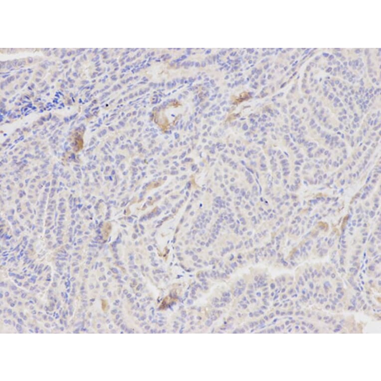 Immunohistochemistry - PCK1 Antibody from Signalway Antibody (32565) - Antibodies.com