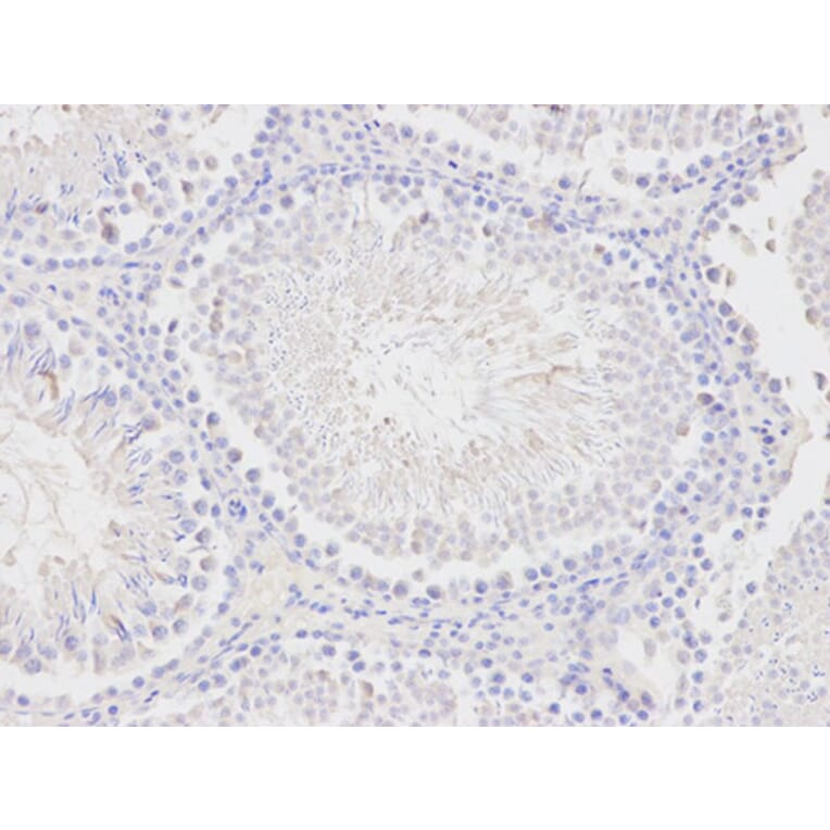 Immunohistochemistry - PCK1 Antibody from Signalway Antibody (32565) - Antibodies.com