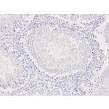 Immunohistochemistry - PCK1 Antibody from Signalway Antibody (32565) - Antibodies.com