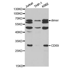 Western blot - CD69 Antibody from Signalway Antibody (32569) - Antibodies.com