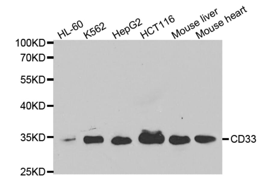 Western blot - CD33 Antibody from Signalway Antibody (32577) - Antibodies.com
