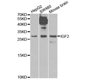 Western blot - IGF2 Antibody from Signalway Antibody (32592) - Antibodies.com