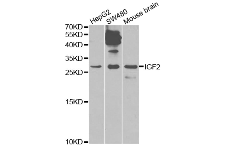 Western blot - IGF2 Antibody from Signalway Antibody (32592) - Antibodies.com