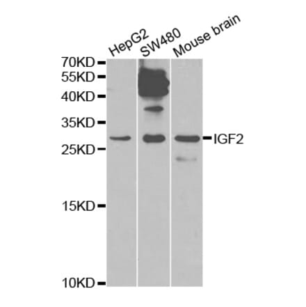 Western blot - IGF2 Antibody from Signalway Antibody (32592) - Antibodies.com