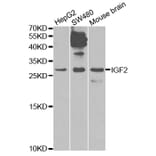 Western blot - IGF2 Antibody from Signalway Antibody (32592) - Antibodies.com