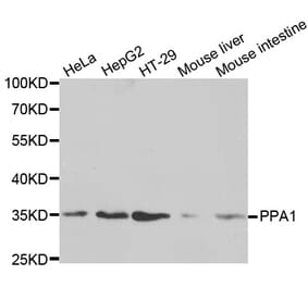 Western blot - PPA1 Antibody from Signalway Antibody (32601) - Antibodies.com