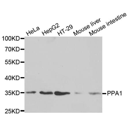 Western blot - PPA1 Antibody from Signalway Antibody (32601) - Antibodies.com