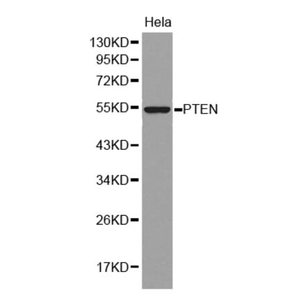 Western blot - PTEN Antibody from Signalway Antibody (32606) - Antibodies.com