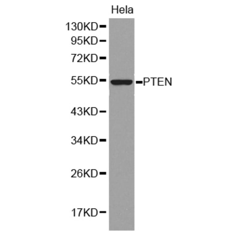 Western blot - PTEN Antibody from Signalway Antibody (32606) - Antibodies.com