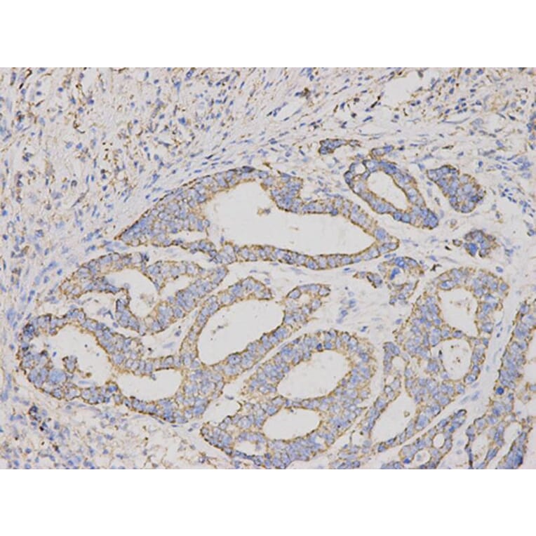 Immunohistochemistry - CUL1 Antibody from Signalway Antibody (32618) - Antibodies.com