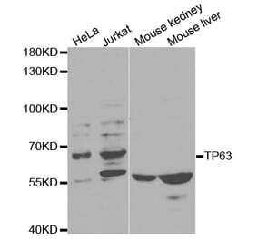 Western blot - TP63 Antibody from Signalway Antibody (32619) - Antibodies.com