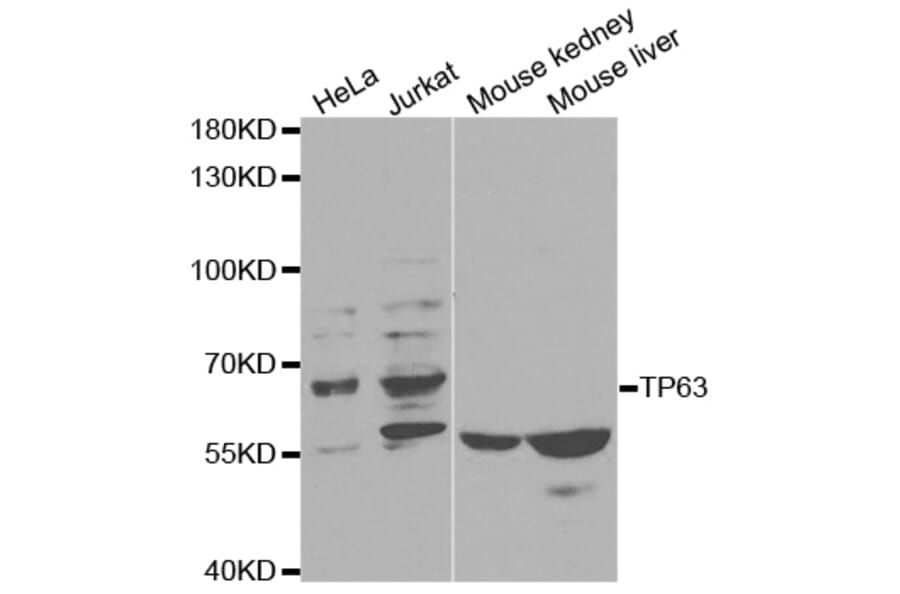 Western blot - TP63 Antibody from Signalway Antibody (32619) - Antibodies.com