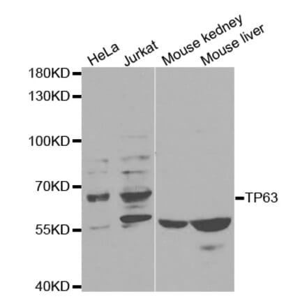 Western blot - TP63 Antibody from Signalway Antibody (32619) - Antibodies.com
