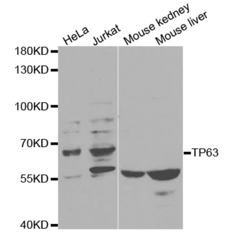 Western blot - TP63 Antibody from Signalway Antibody (32619) - Antibodies.com
