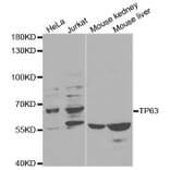 Western blot - TP63 Antibody from Signalway Antibody (32619) - Antibodies.com