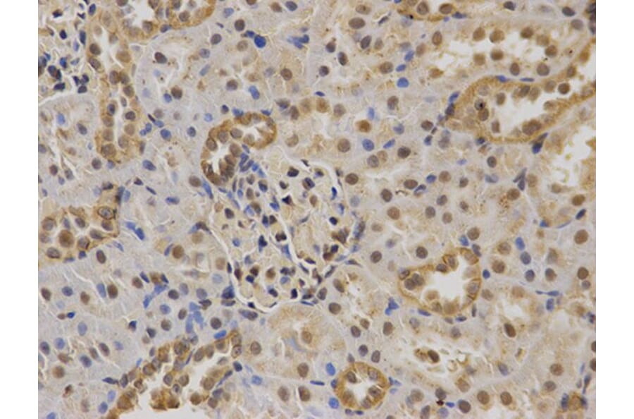 Immunohistochemistry - TP63 Antibody from Signalway Antibody (32619) - Antibodies.com