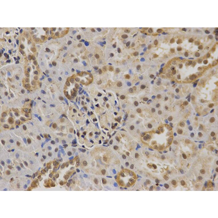Immunohistochemistry - TP63 Antibody from Signalway Antibody (32619) - Antibodies.com