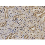 Immunohistochemistry - TP63 Antibody from Signalway Antibody (32619) - Antibodies.com