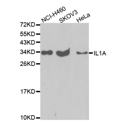 Western blot - IL1A Antibody from Signalway Antibody (32638) - Antibodies.com
