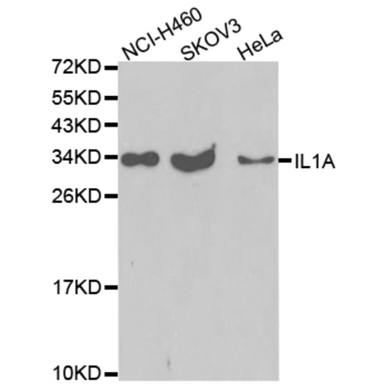 Western blot - IL1A Antibody from Signalway Antibody (32638) - Antibodies.com