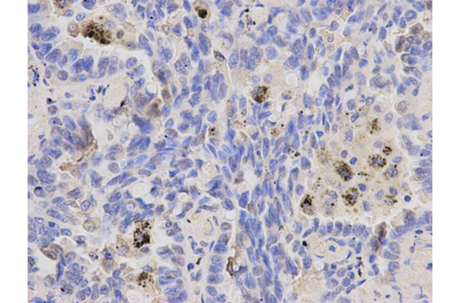 Immunohistochemistry - IL1A Antibody from Signalway Antibody (32638) - Antibodies.com