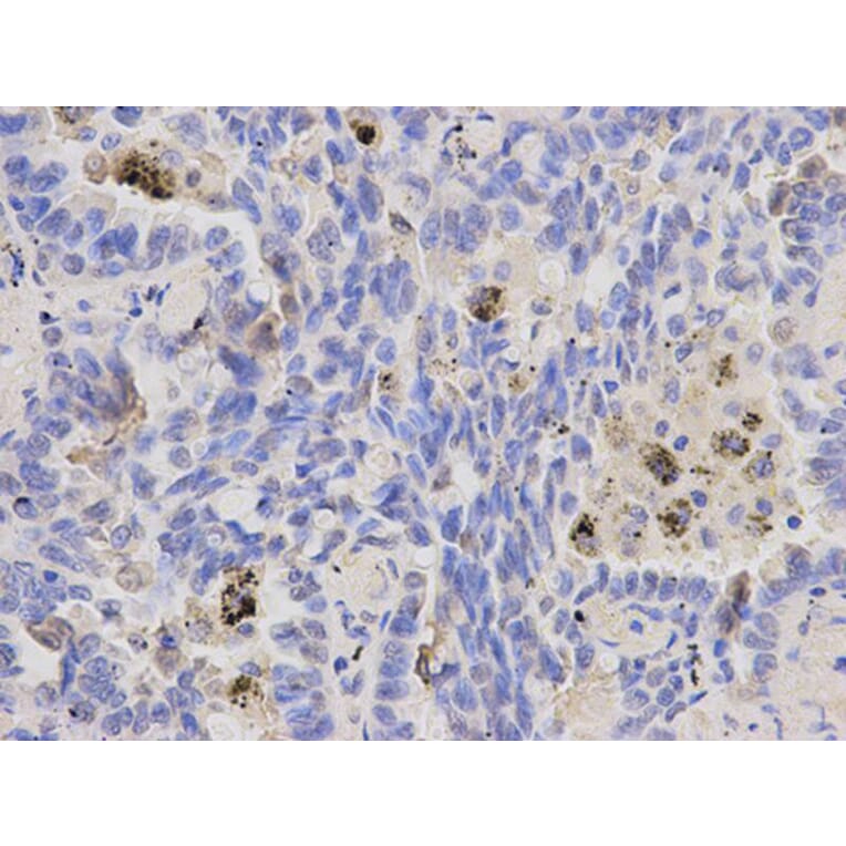 Immunohistochemistry - IL1A Antibody from Signalway Antibody (32638) - Antibodies.com