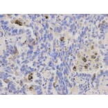 Immunohistochemistry - IL1A Antibody from Signalway Antibody (32638) - Antibodies.com
