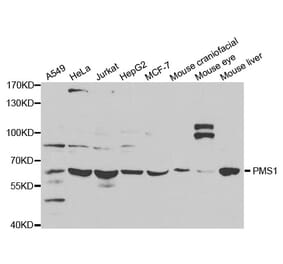 Western blot - PMS1 Antibody from Signalway Antibody (32648) - Antibodies.com