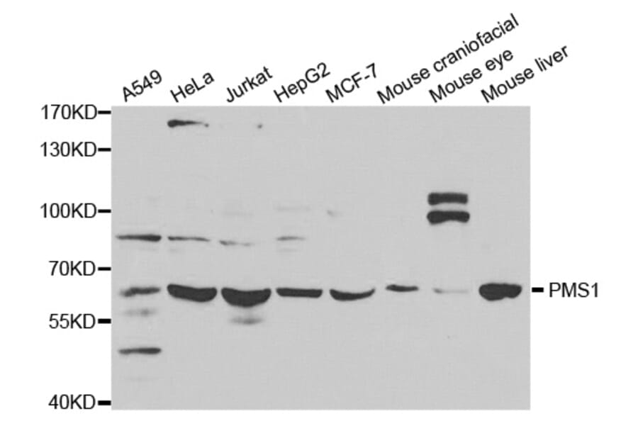 Western blot - PMS1 Antibody from Signalway Antibody (32648) - Antibodies.com