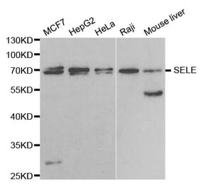 Western blot - SELE Antibody from Signalway Antibody (32655) - Antibodies.com