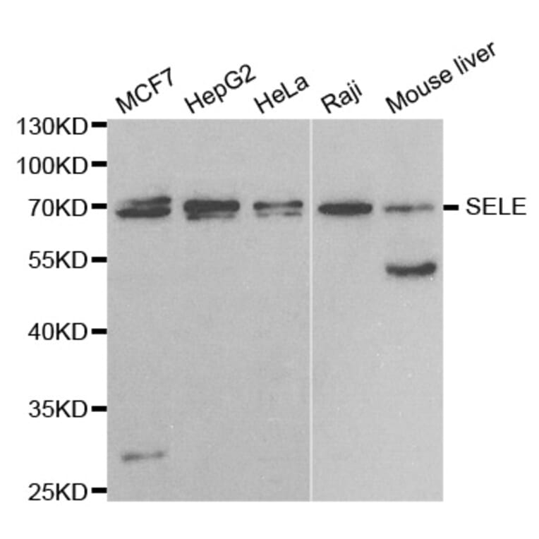 Western blot - SELE Antibody from Signalway Antibody (32655) - Antibodies.com