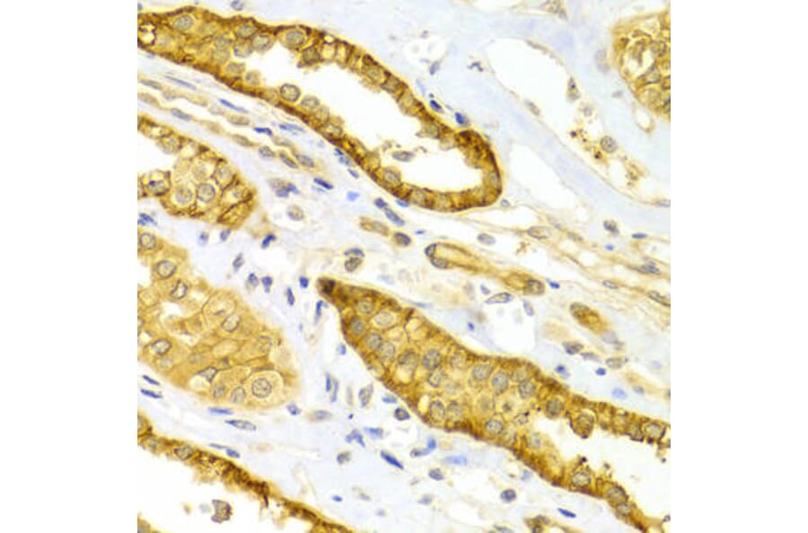 Immunohistochemistry - SELE Antibody from Signalway Antibody (32655) - Antibodies.com