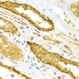 Immunohistochemistry - SELE Antibody from Signalway Antibody (32655) - Antibodies.com