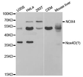 Western blot - NOX4 Antibody from Signalway Antibody (32663) - Antibodies.com