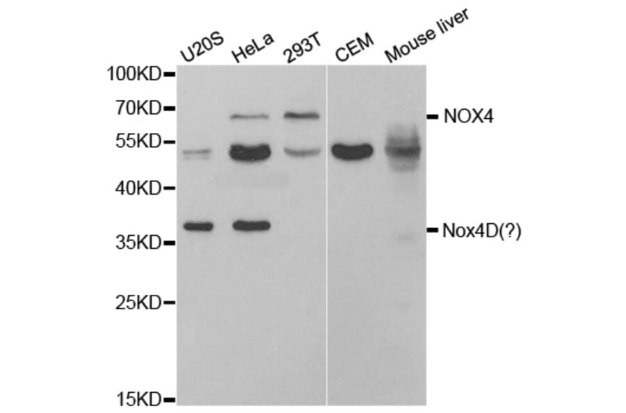 Western blot - NOX4 Antibody from Signalway Antibody (32663) - Antibodies.com