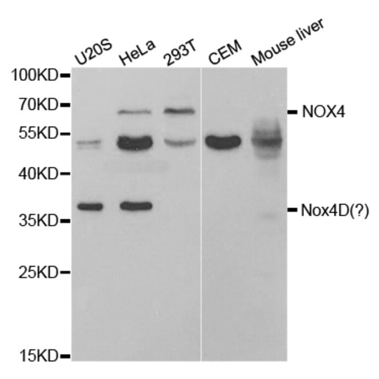 Western blot - NOX4 Antibody from Signalway Antibody (32663) - Antibodies.com