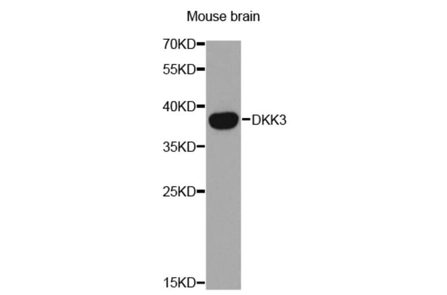 Western blot - DKK3 Antibody from Signalway Antibody (32693) - Antibodies.com