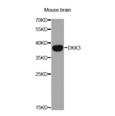 Western blot - DKK3 Antibody from Signalway Antibody (32693) - Antibodies.com