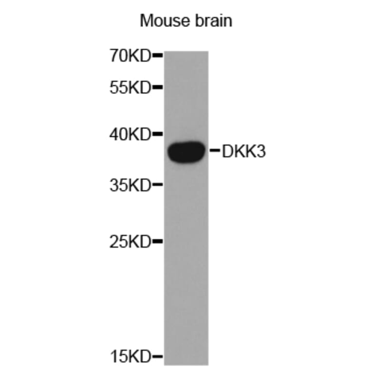 Western blot - DKK3 Antibody from Signalway Antibody (32693) - Antibodies.com