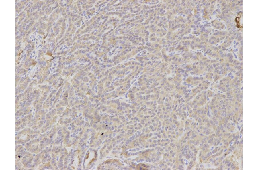 Immunohistochemistry - DKK3 Antibody from Signalway Antibody (32693) - Antibodies.com