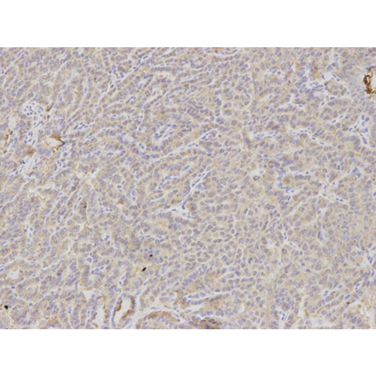 Immunohistochemistry - DKK3 Antibody from Signalway Antibody (32693) - Antibodies.com