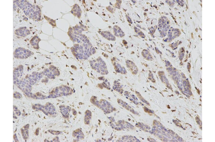 Immunohistochemistry - DKK3 Antibody from Signalway Antibody (32693) - Antibodies.com