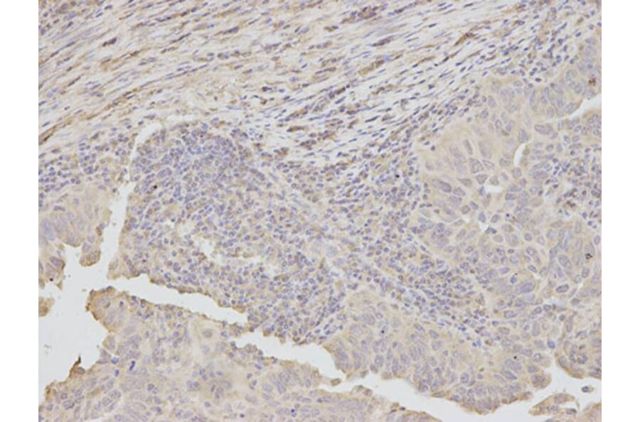 Immunohistochemistry - DKK3 Antibody from Signalway Antibody (32693) - Antibodies.com